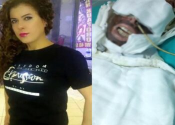 Avcılar’da Kimyasal Saldırıya Uğrayan Kadının Davası Devam Edildi