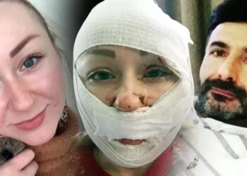 Eşinin Yüzünü Falçatayla Yaralayan Adam Tahliye Edildi