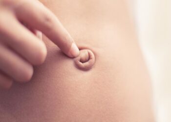 Göbek Fıtığı 4 Yaşından Sonra Cerrahi Tedavi Gerektirebilir