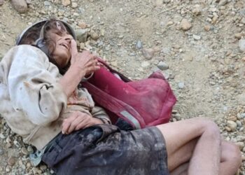 Maden Sahasında Bulunan Fransız Kadın Yoğun Bakımda