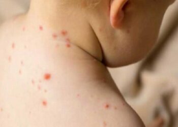 Risk grubundakiler için hayati tehlike olabiliyor