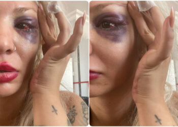 Yüzyüzeyken Konuşuruz Gitaristi Can Tunaboylu’ndan Sevgilisine Şiddet İddiası