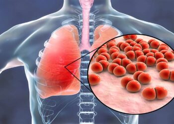 Zatürre Ölümle Sonuçlanan Beşinci Hastalık