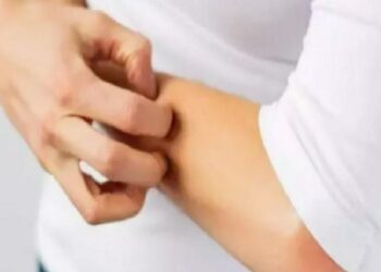 Zonanın en değerli nedeni gerilim